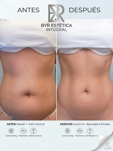 Antes y después