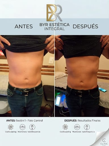 Antes y después masculino