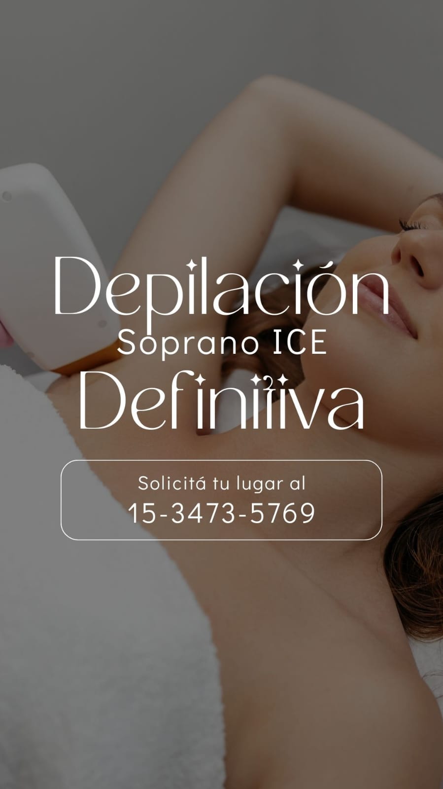 Depilación Soprano